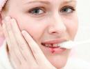 Что делать, если началось кровотечение после удаления зуба